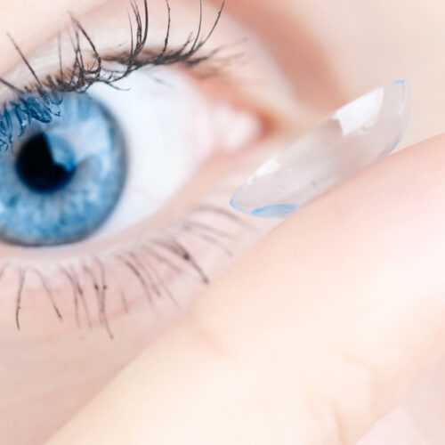 Contact Lens